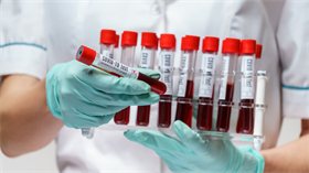 Группа крови никак не влияет на риск заражения и тяжесть течения коронавируса